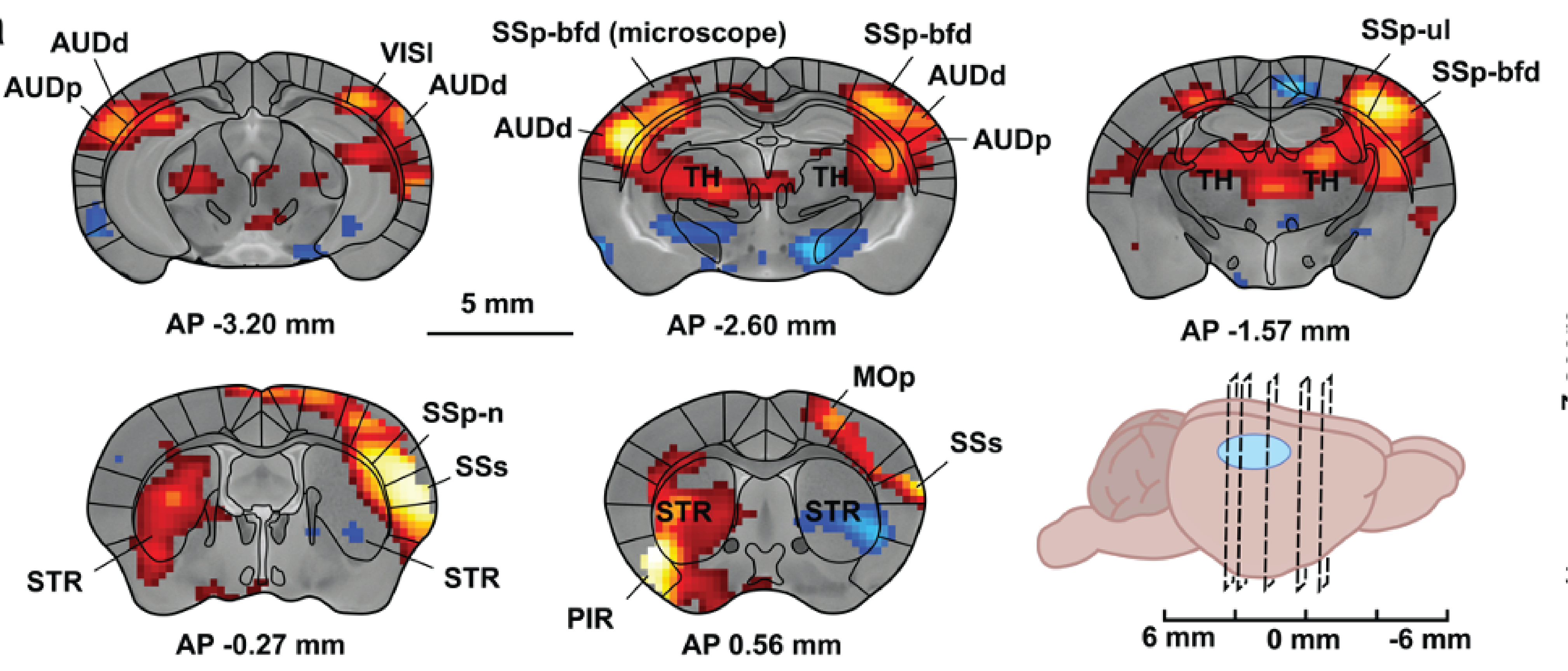 mri_imaging.png